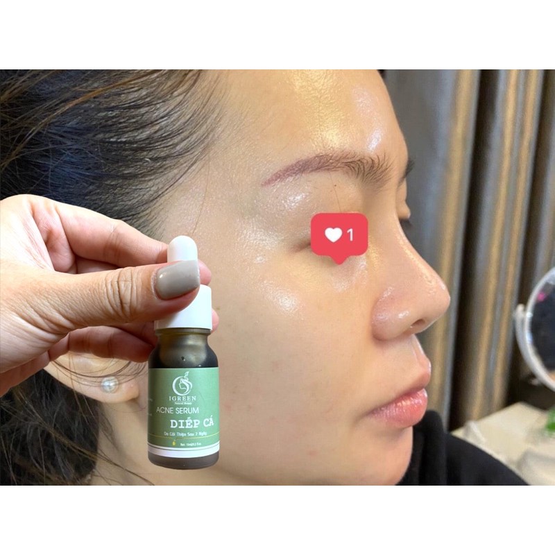 Serum Diếp Cá handmade - giảm mụn, thâm, dưỡng da căng bóng | BigBuy360 - bigbuy360.vn