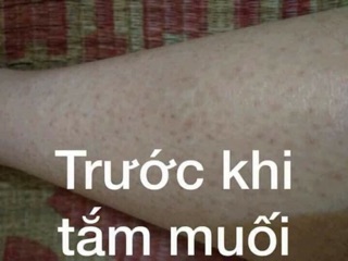 MUỐI TẮM SỮA NON