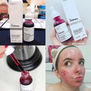 TẨY DA CHẾT HOÁ HỌC + THANH TẨY DA The Ordinary AHA 30% & BHA 2% Peeling Solution