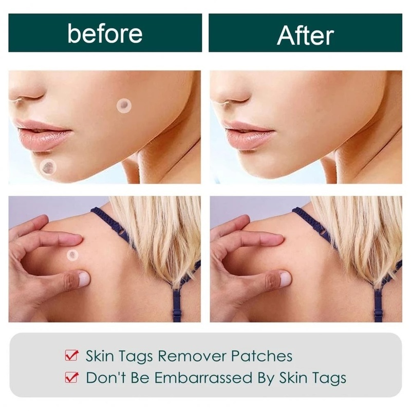 Bộ 36 Miếng Dán Gel Hydrocolloid Chống Nhiễm Trùng Chăm Sóc Da Mặt