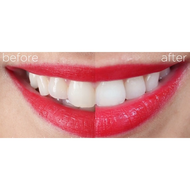 Kem Đánh Răng Crest 3D White Luxe Glamorous White