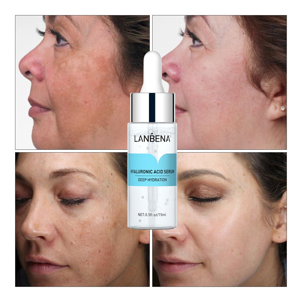 Tinh Chất Chăm Sóc Da LANBENA Hyaluronic Acid Làm Trắng Dưỡng Ẩm Chống Lão Hóa Và Nếp Nhăn 15ml
