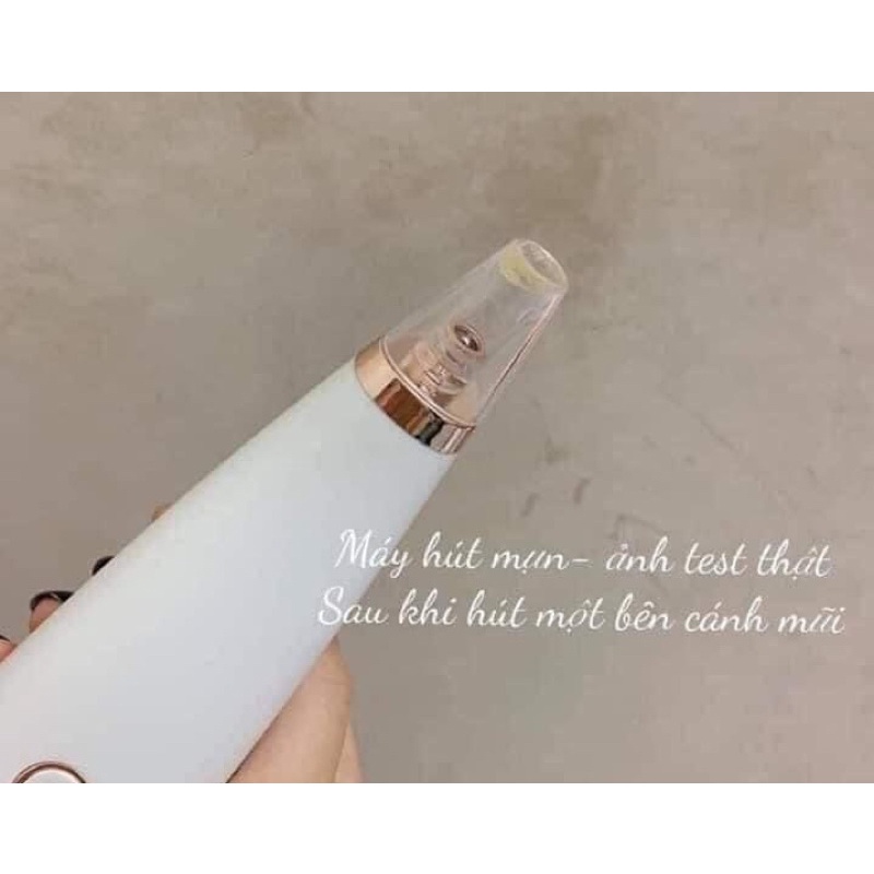 MÁY HÚT MỤN MINI SIÊU TIỆN DỤNG, BlackHeadDetector ( Hàng cao cấp)