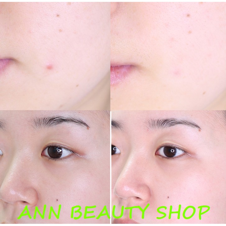 Serum Phục Hồi Và Tái Tạo Da Some By Mi Snail Truecica Miracle Repair 50ml | BigBuy360 - bigbuy360.vn