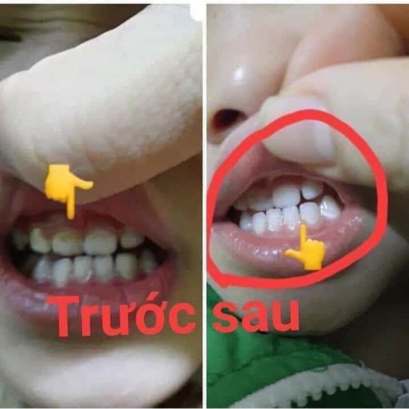 Thảo dược răng miệng nhật dương
