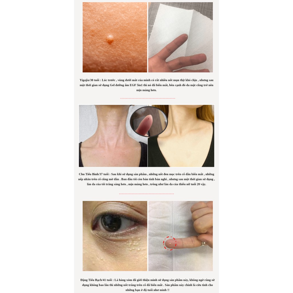 Gel dưỡng da EGF 5in1 Churacos Warabihada | BigBuy360 - bigbuy360.vn