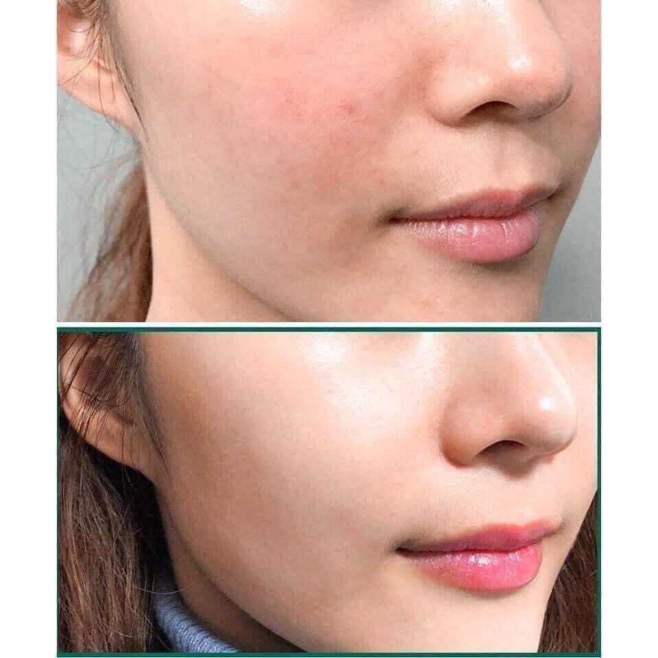 Toner Dưỡng Sáng Đều Màu Da The Ordinary Glycolic Acid 7% Toning Solution 240ml | BigBuy360 - bigbuy360.vn