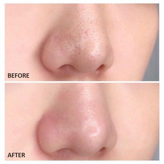 Miếng Dán Mũi Lột Mụn Bioré Pore Pack