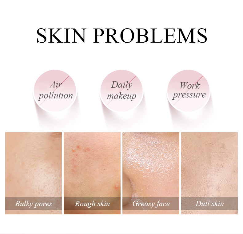 Mặt Nạ Bùn Hoa Anh Đào Laikou Dưỡng Ẩm Kiềm Dầu Se Khít Lỗ Chân Lông | BigBuy360 - bigbuy360.vn