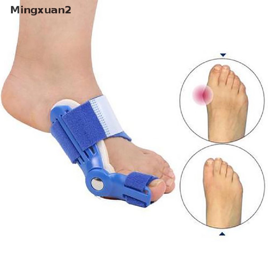 Bộ 2 dụng cụ chỉnh hình ngón chân cái giảm đau hiệu quả
 | BigBuy360 - bigbuy360.vn