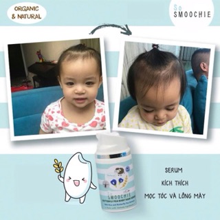 Serum kích thích mọc tóc