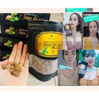 Kẹo mầm sâm tố nữ plus x2 thảo mộc 37-kèm quà tặng