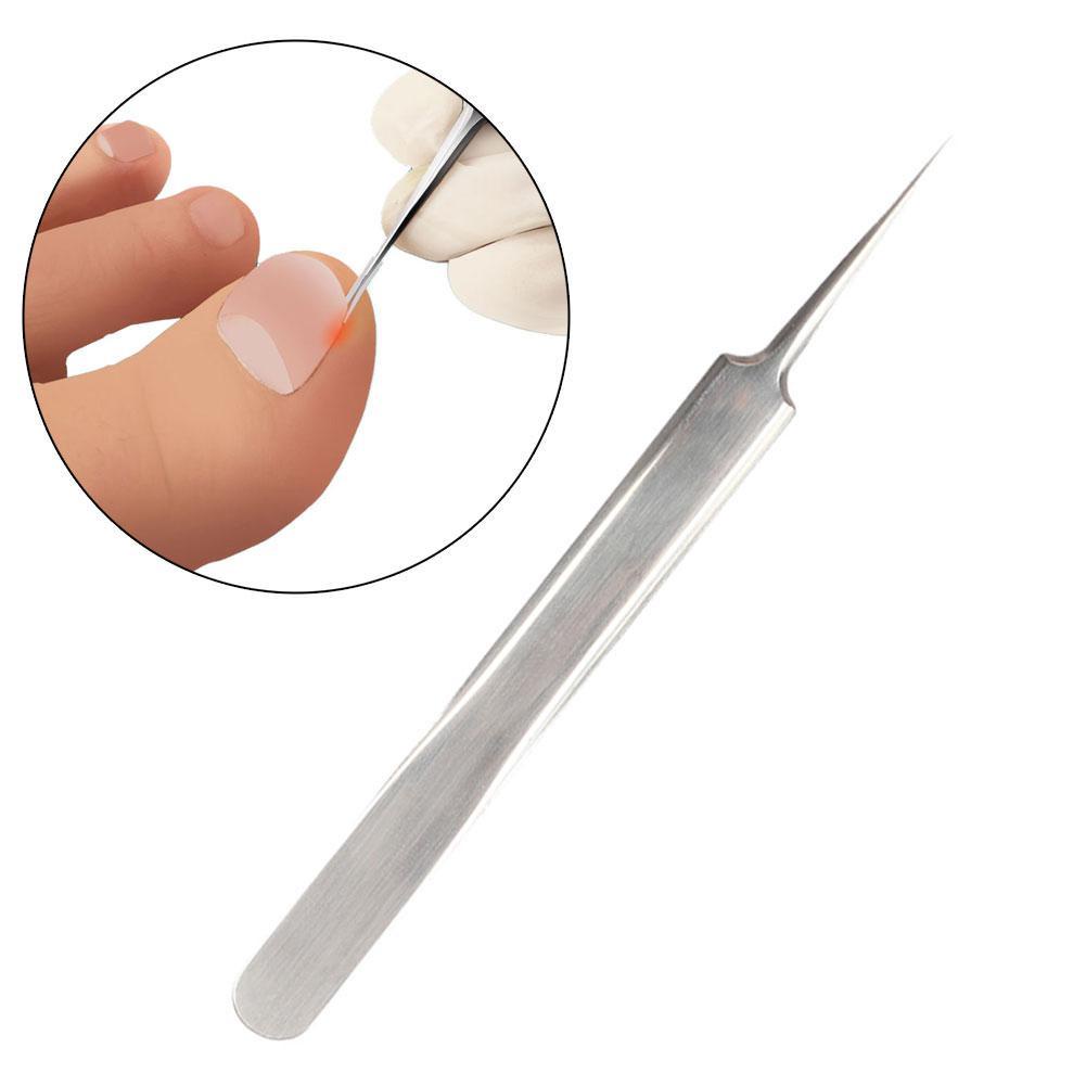 Bộ dụng cụ chỉnh hình móng chân co giãn U2W3