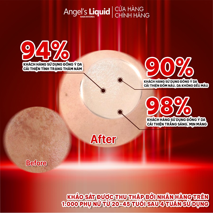 Kem Dưỡng Tranexamic Acid Mờ Nám Chuyên Sâu Angel's Liquid Mela Cream 50ml
