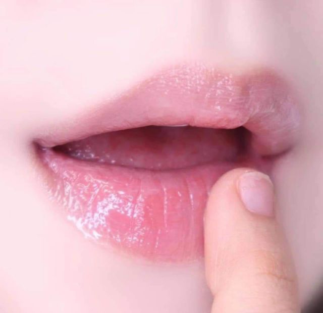 Ủ MÔI YNM LIP TREATMENT PACK | BigBuy360 - bigbuy360.vn