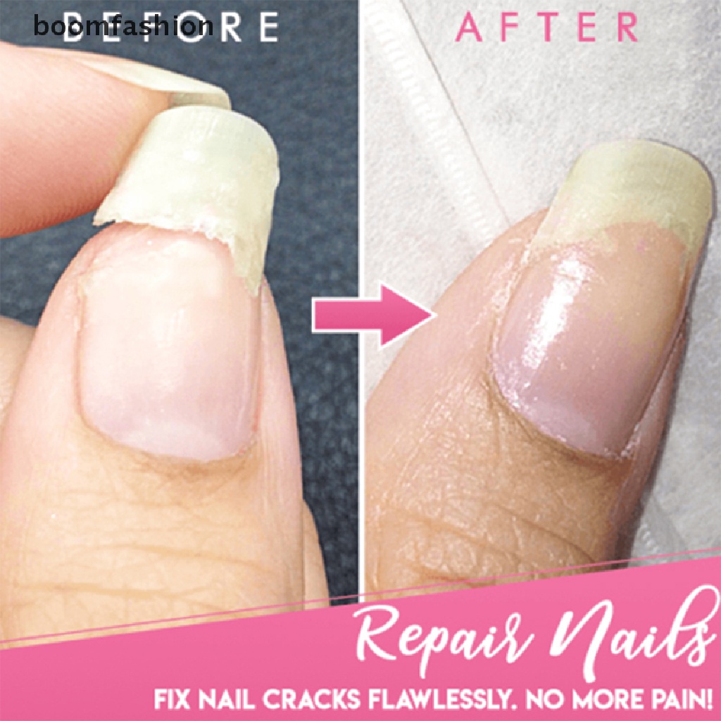 [boomfashion] 20ml Cracked Nail Repair Gel Polish Fiberglass Extension Building UV Nail Gels [new]