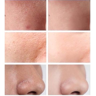 Serum se khít lỗ chân lông