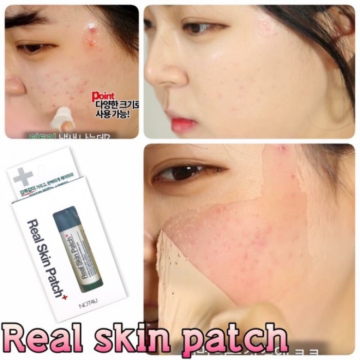 Gel Che Mụn Thần Thánh Not4U Real Skin Patch