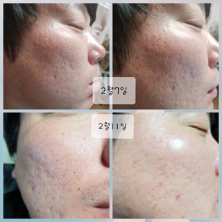 Bộ đôi serum xit khoáng incellderm