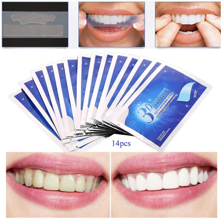 Miếng dán trắng răng 3D White teeth trắng răng sau 7 ngày