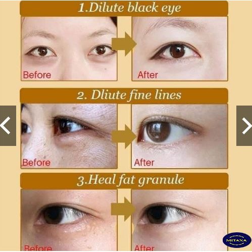 Mặt Nạ Dưỡng Da Quầng Thâm Mắt Collagen Crystal Eyes