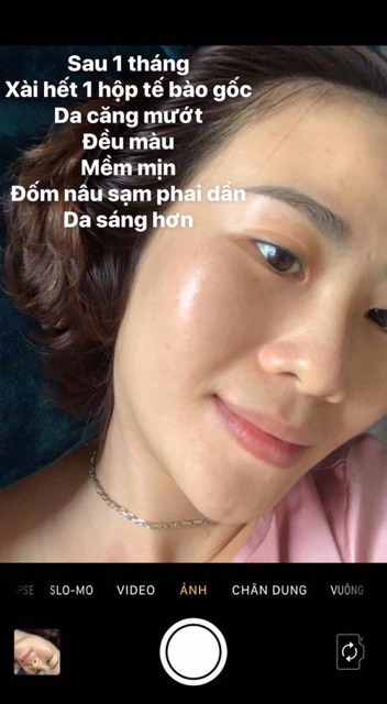 TẾ BÀO GỐC VẠN NĂNG COSMEHEAL SUPER SHINE CĂNG BÓNG - TRẮNG DA CẢI THIỆN SẸO RỖ