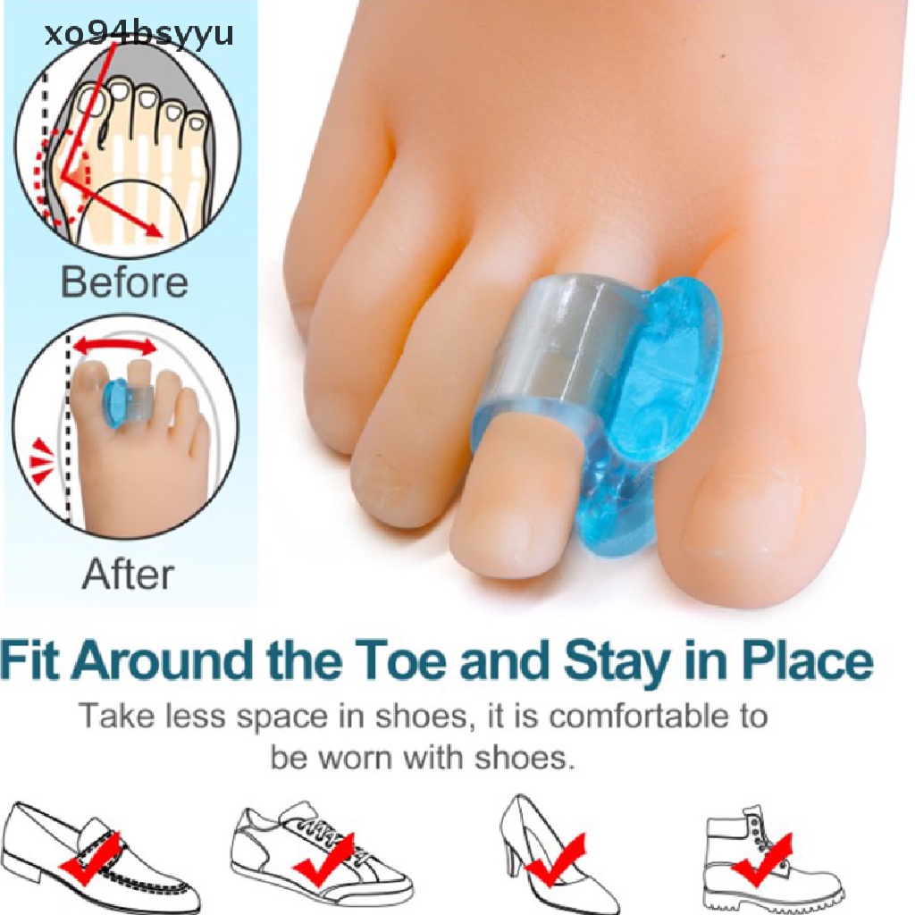 [Hàng mới về] Set 2 dụng cụ chỉnh hình ngón chân cái bằng silicon mềm