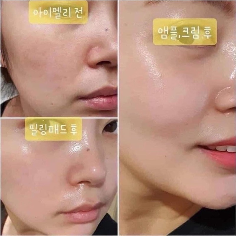 SERUM CẤP ẨM PHỤC HỒI DA B5 MEDIK8