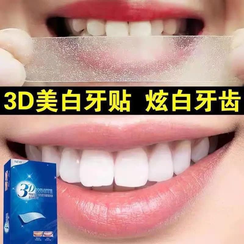 Miếng dán trắng răng 3D