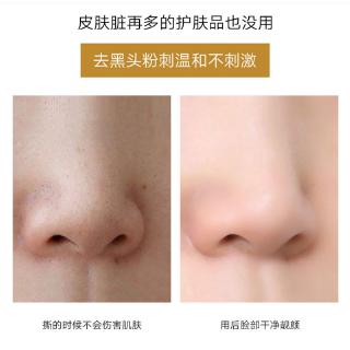 KADIKA Effective oil control blackhead remover mask