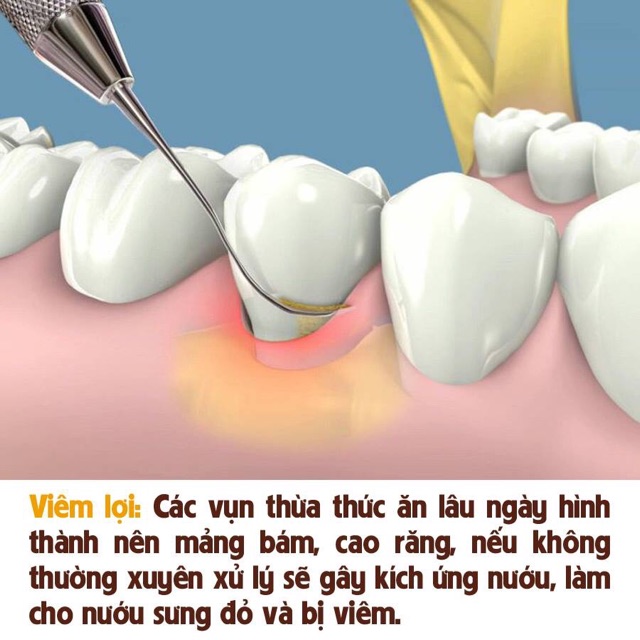 Nước súc miệng Cololo Nhật Bản giá KM 345k