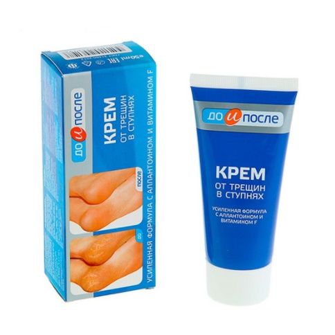 Kem nẻ gót chân Kpem Foot Cream giảm nẻ chân, nứt chân, khô da chân, dưỡng gót chân