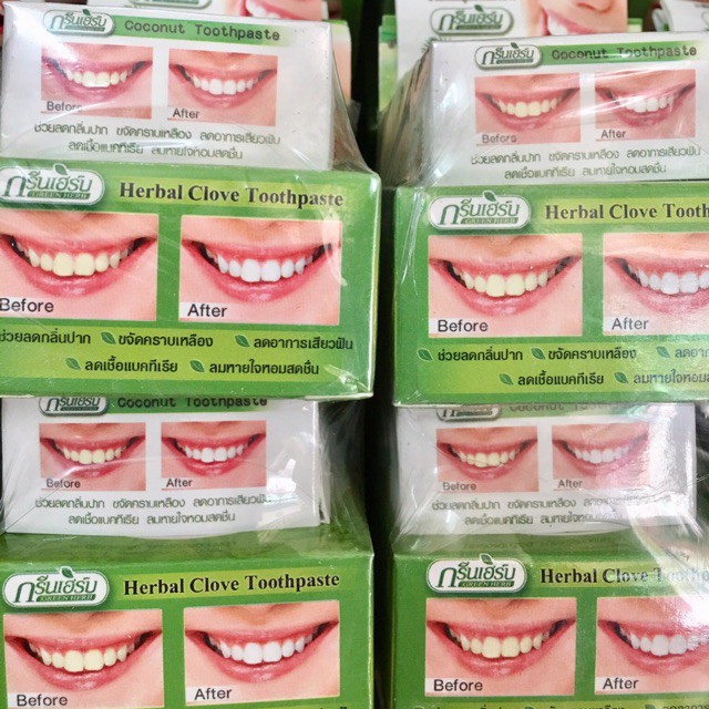 Tẩy trắng răng Thái Lan