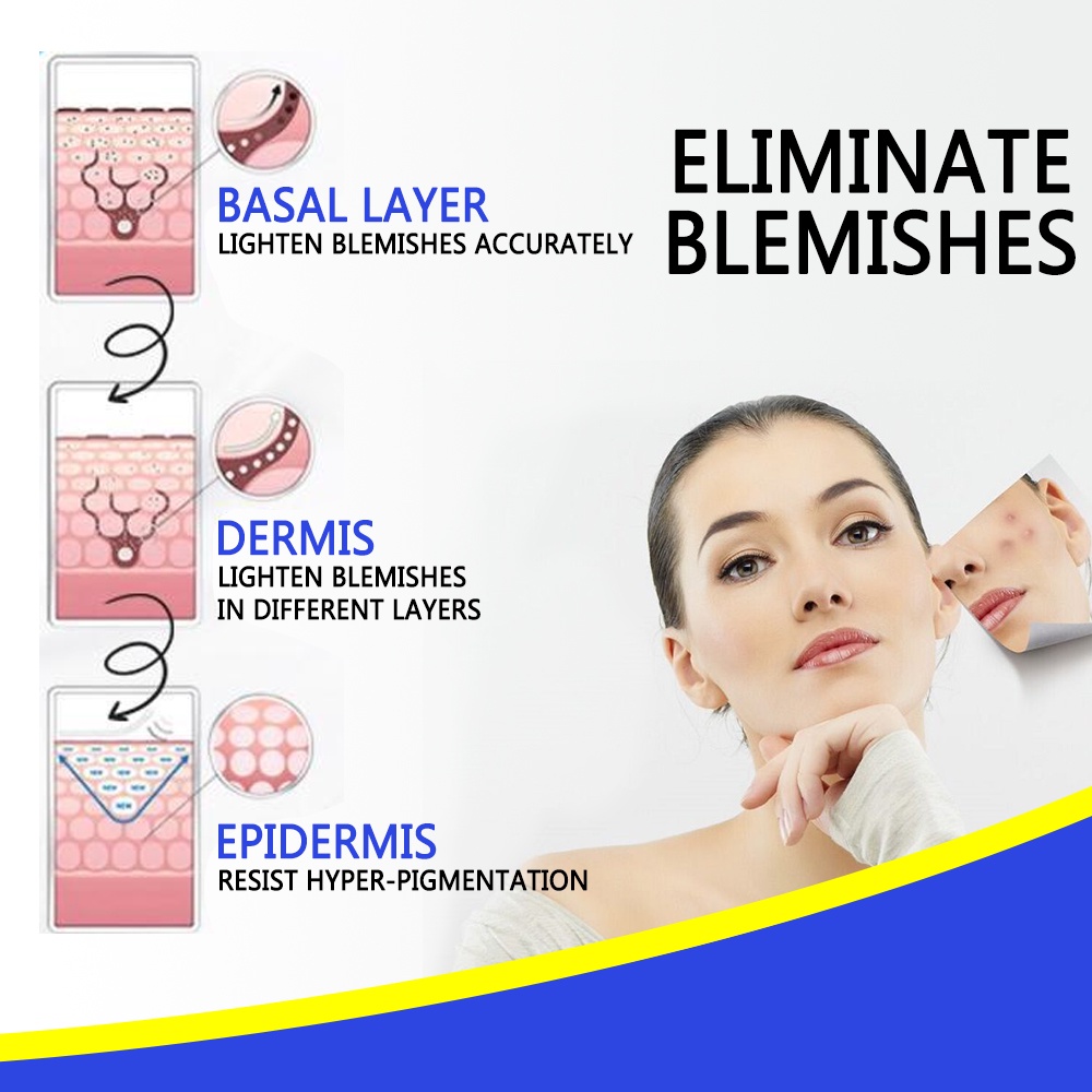 Kem dưỡng trắng da ANNIES 30ml giúp làm mờ sẹo và vết thâm hiệu quả