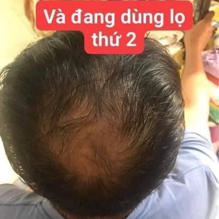 [Hàng cao cấp] Serum Dr Hair kích mọc tóc, mày , mi