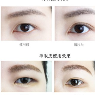 Vỉ miếng dán kích mí siêu tiện lợi