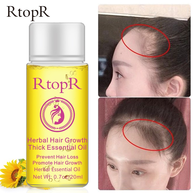 Tinh Dầu Dưỡng Tóc RtopR Kích Thích Mọc Tóc 20ml | BigBuy360 - bigbuy360.vn