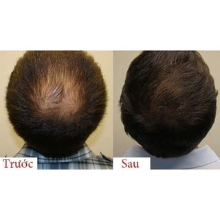 Tinh Chất dưỡng Tóc SATO Nhật Bản 30ml