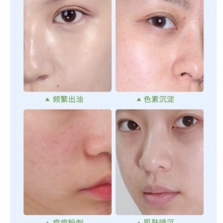 Sữa Rửa Mặt Heyxi Chiết Xuất Lô Hội Làm Sạch Sâu Kiềm Dầu Dưỡng Ẩm Cho Nam Và Nữ HSRM2 | BigBuy360 - bigbuy360.vn