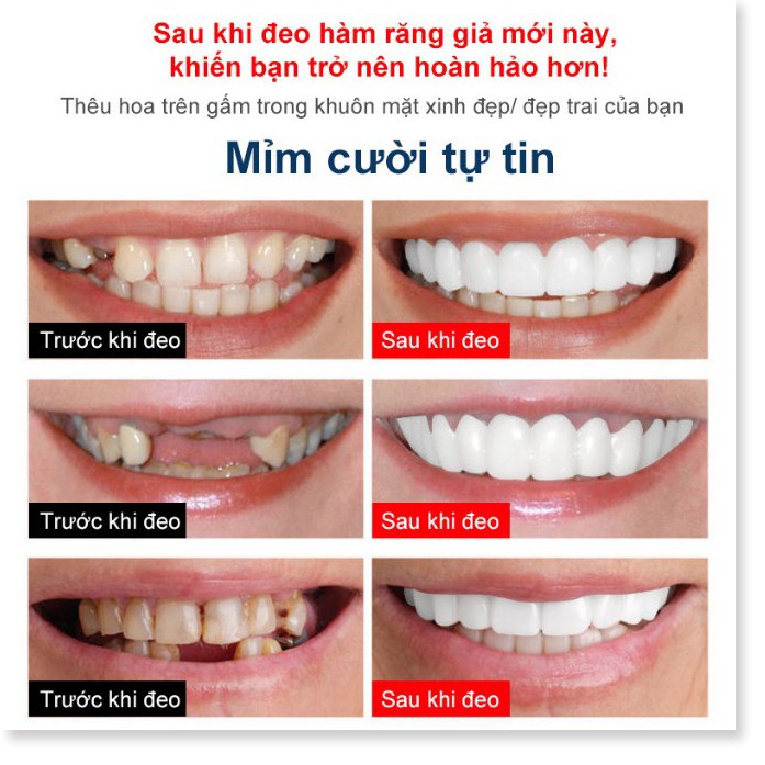 Dụng cụ làm đẹp an toàn Hàm răng giả bằng silicon -TTHome