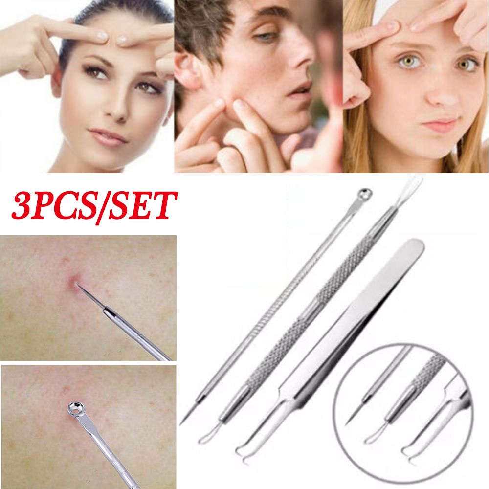 [Hàng mới về] Set 3 dụng cụ nặn mụn bằng thép không gỉ chăm sóc da nhanh chóng tiện dụng