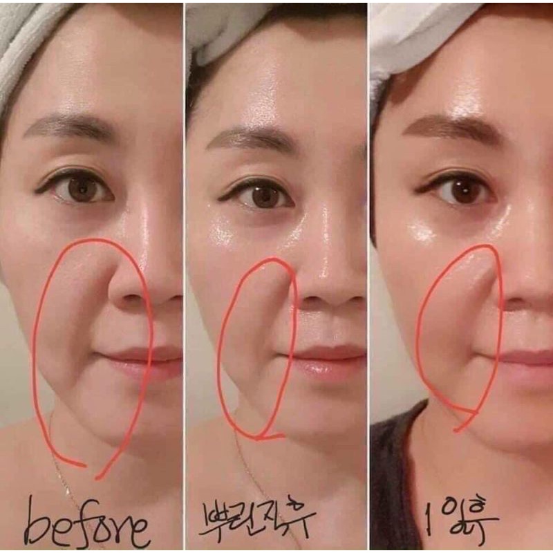 Gel Nâng Cơ Xóa Nhăn CareCella Facial line up lifting gel 1 hộp/4 gói x 9ml, tuyển sỉ, CTV IB