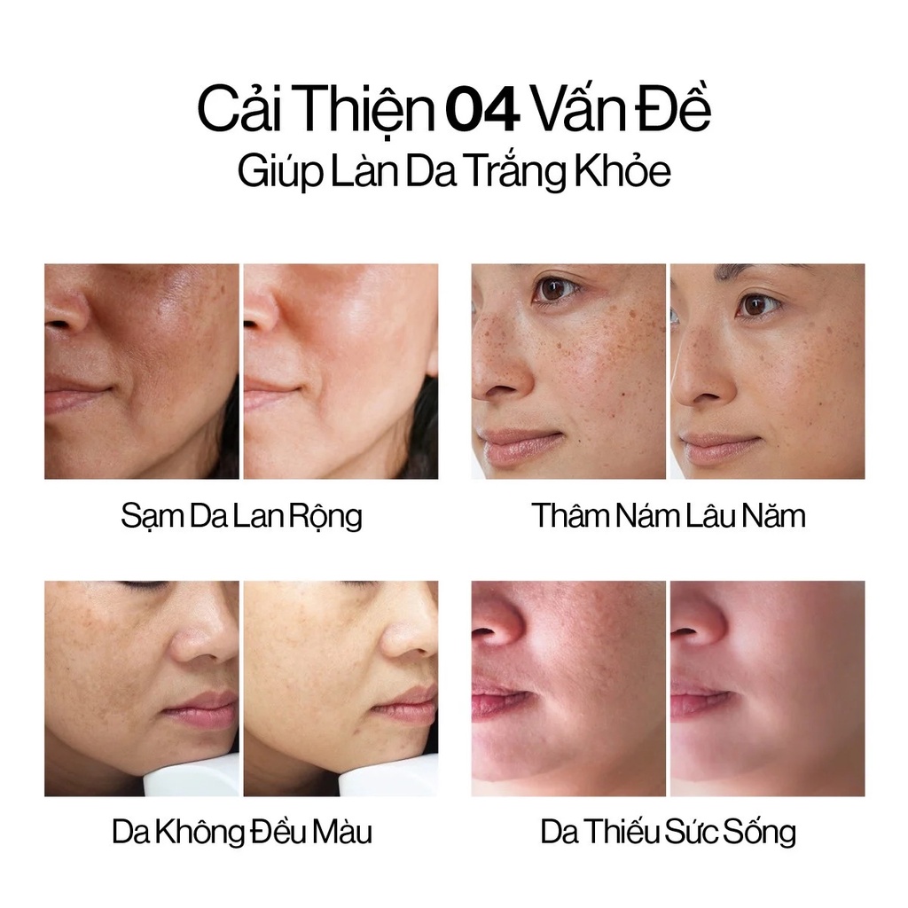 Bộ 4 sản phẩm dưỡng trắng và phục hồi da Gilaa Saffron Tone Up Repair