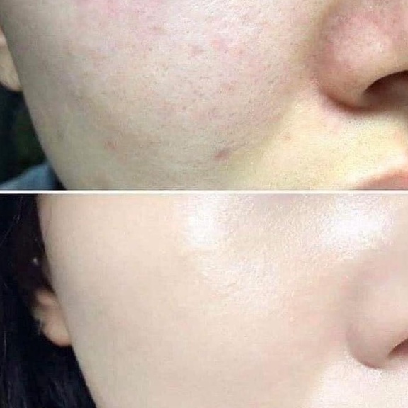 Kem nền trang điểm vdl foundation nâng tông da sáng đẹp, mịn màng mini 5ml