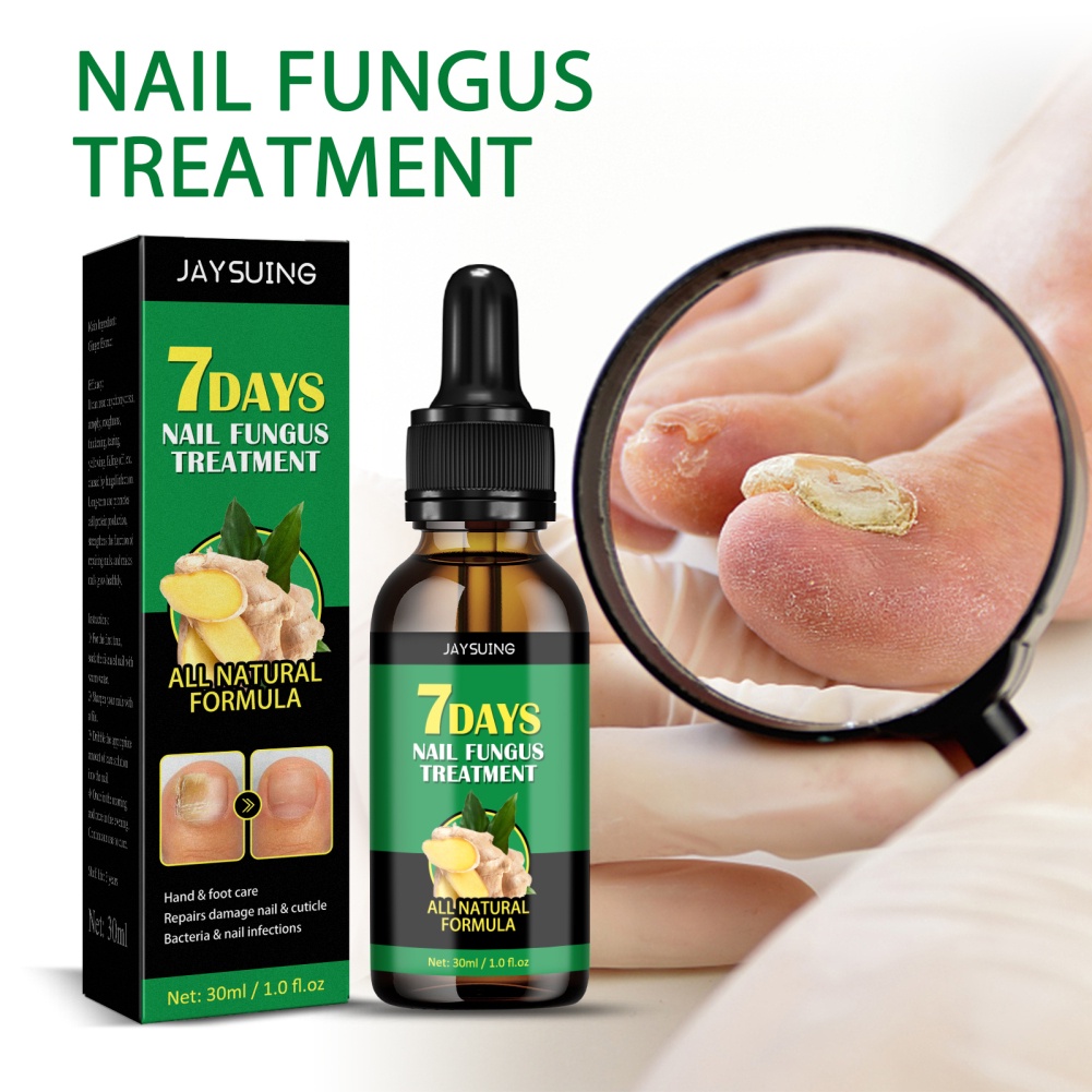Tinh chất JULYSTAR gừng 7 ngày loại bỏ nấm/ chống nhiễm trùng chăm sóc móng tay/ chân