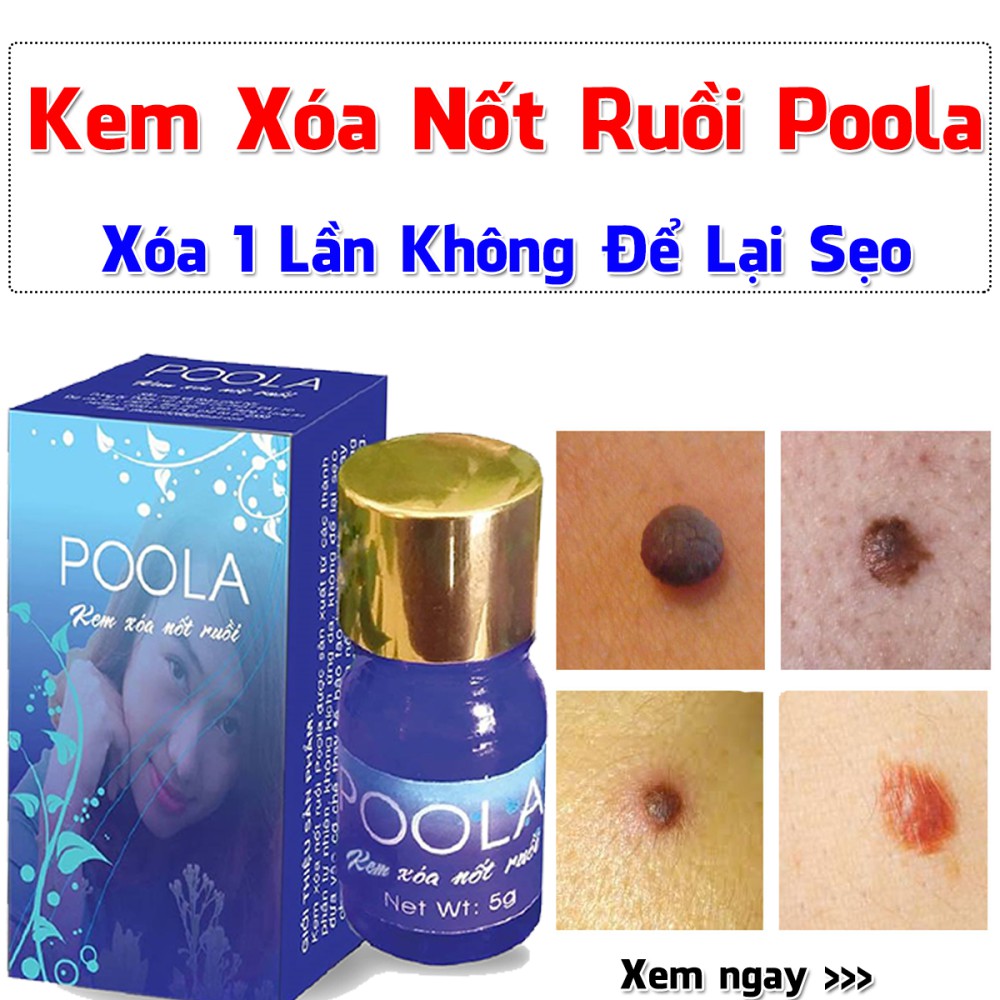 KEM XOÁ NỐT RUỒI POOLA