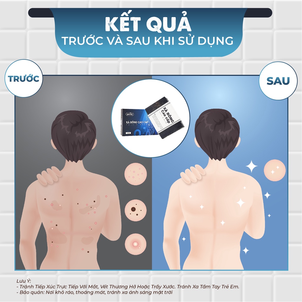 Xà phòng thảo dược Oniiz 130gr - hỗ trợ mờ thâm, sạch mụn, sáng da