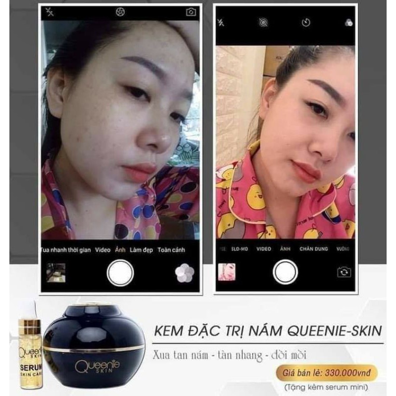 Kem Nám Queenie Skin ( Hàng chính hãng )