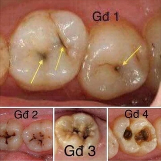 THUỐC ĐÔNG Y NHẬT DƯƠNG