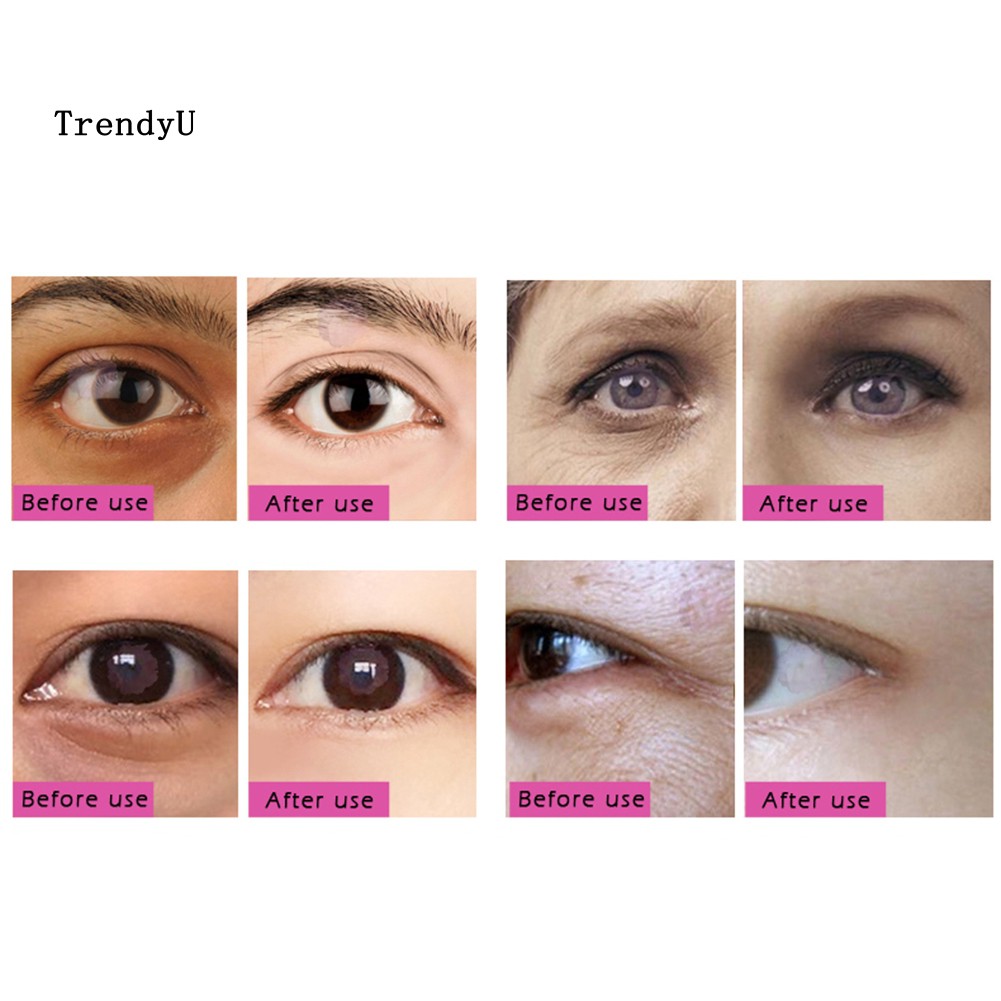 [Hàng mới về] Set 2 miếng nạ mắt chống lão hóa và nếp nhăn | BigBuy360 - bigbuy360.vn